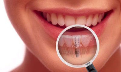 Generic placeholder image